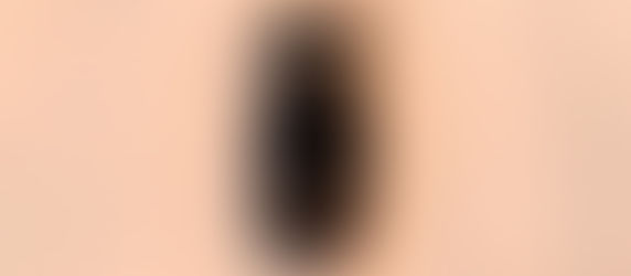 O ciclo de vida do implante dentário: como gerenciar no consultório?