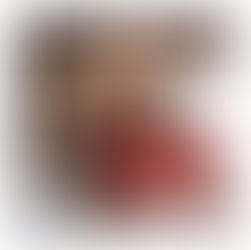 הסרת קעקוע משאירה סימן? האם העור נותר מצולק? זה מאוד כואב? האם אפשר לעשות קאבר אח״כ?