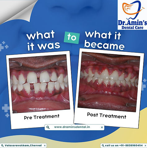 Smile with confidence