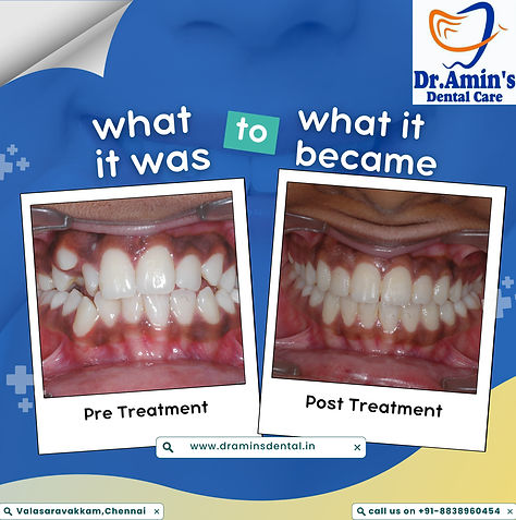 Smile with confidence