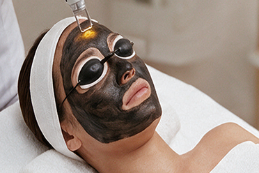 Carbon laser peel facial treatment on woman
