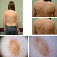 SKIN SURG