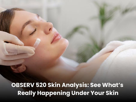 OBSERV 520
