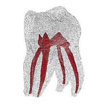 Endo_26_4wurzl-removebg-preview.png