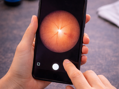 7 dicas para melhorar suas fotos de retina no celular