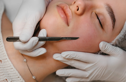 dermaplaning wilmette