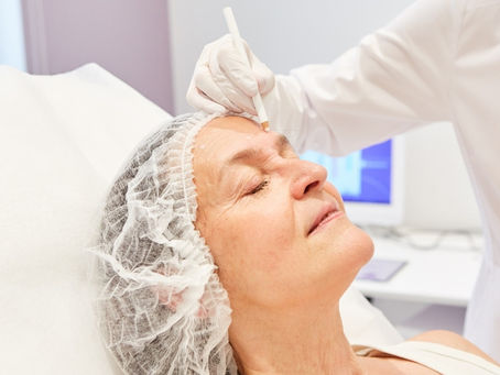 patient having facelift surgery