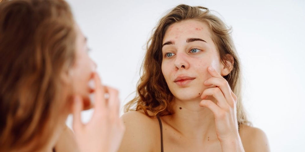 laser skin treatment for pigmentation