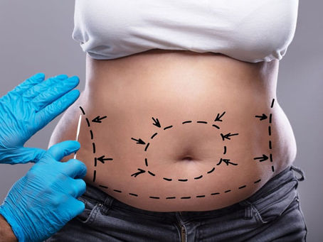 fat removal vs fat freezing