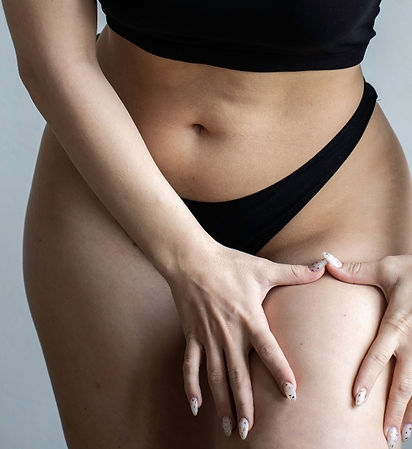 results of cellulite treatment