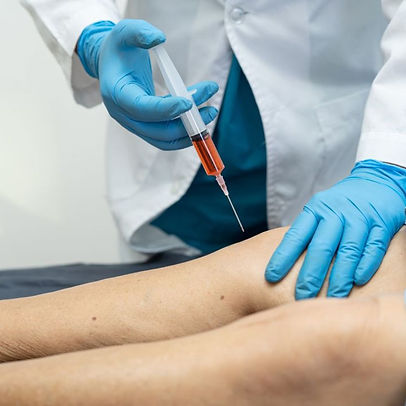 prp injections