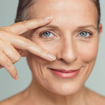 Blepharoplasty in Dublin