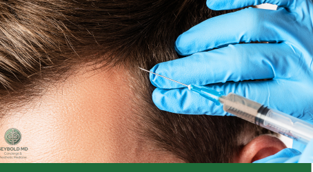 PRP - Platelet-Rich Plasma In Fort Lauderdale