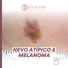 Nevos Atípicos e melanoma