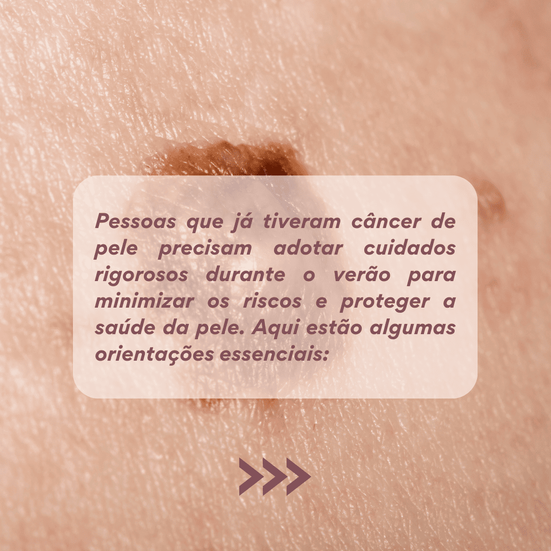 Teve cãncer de pele?
