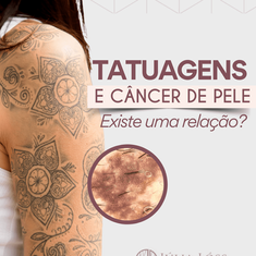 Tatuagens e câncer de pele: Existe uma relação?