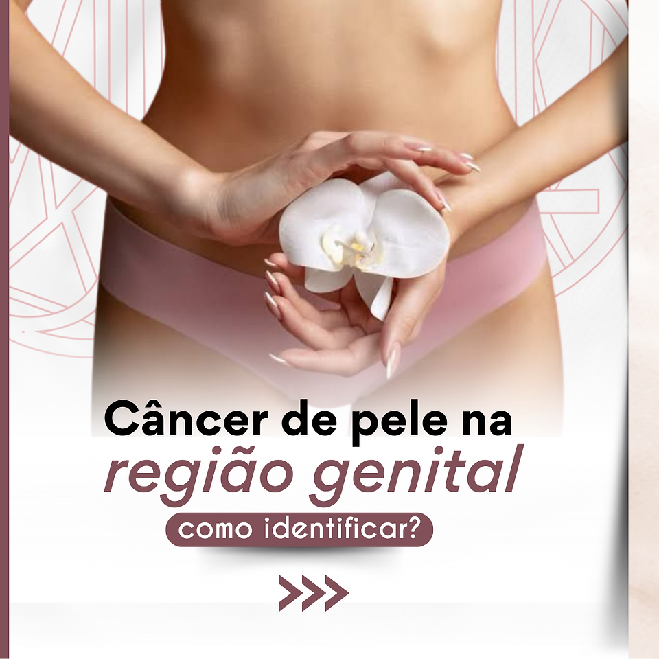 Câncer de pele na região genital