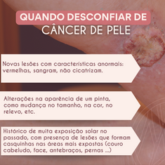 Quando desconfiar de câncer de pele