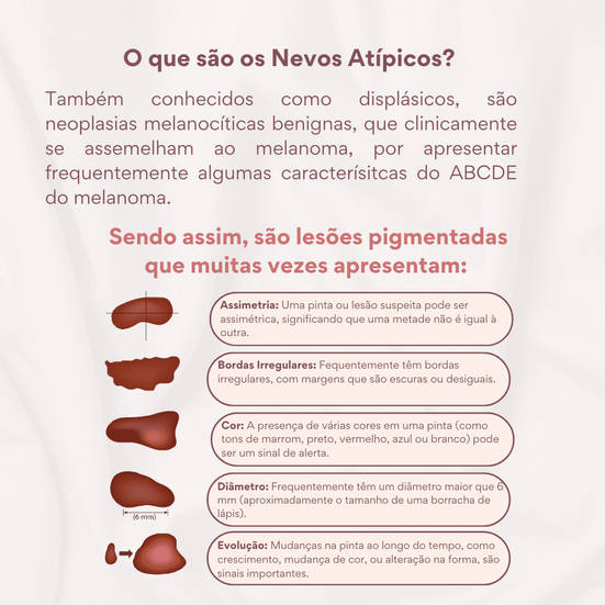 nevos atípicos