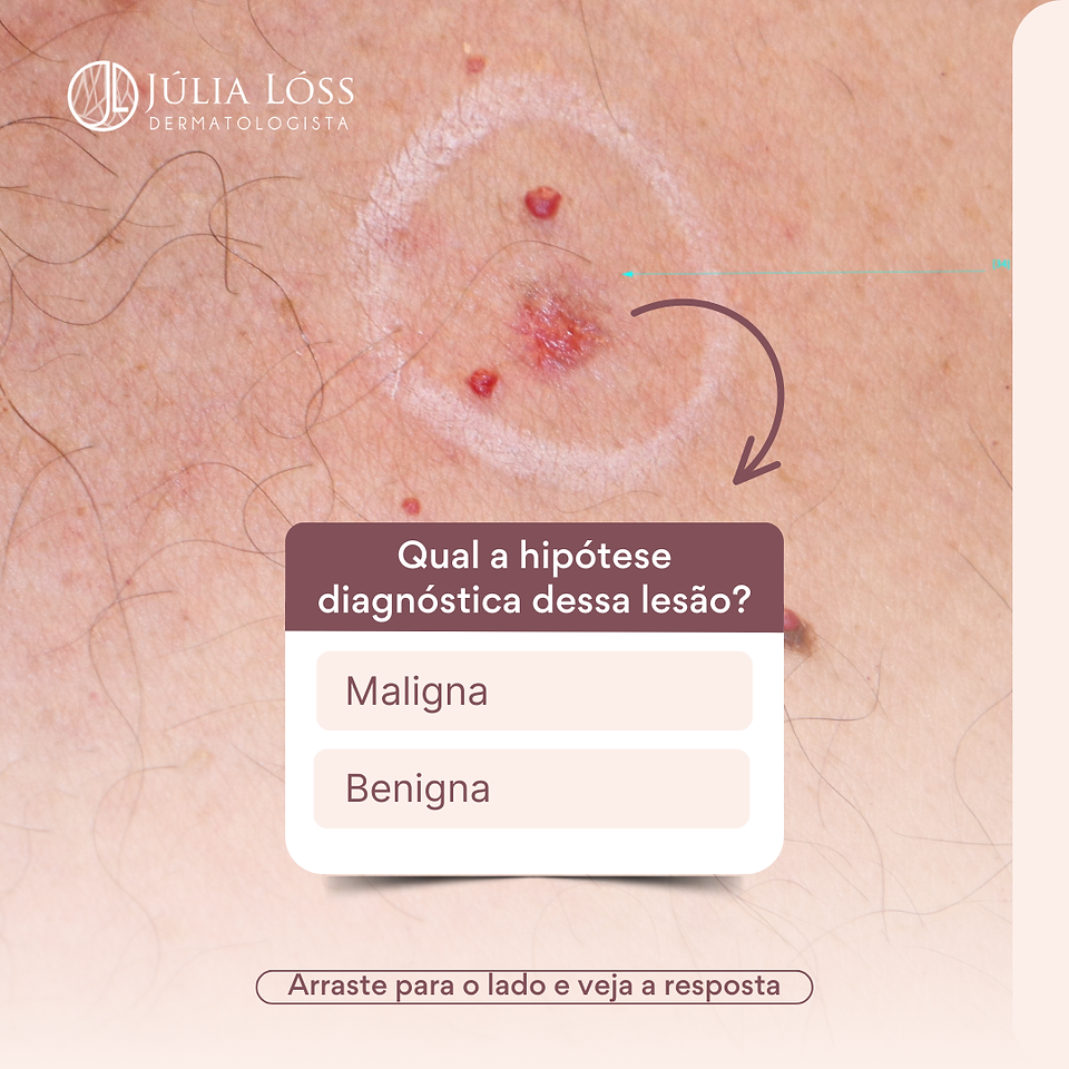 diagnóstico de uma lesão