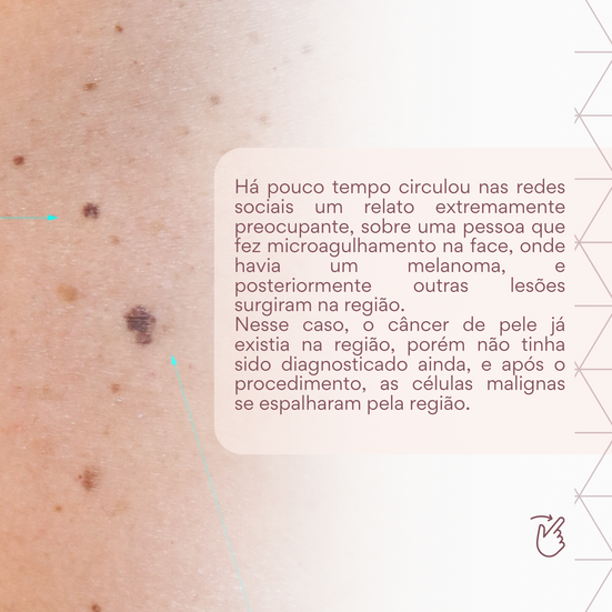 procedimentos estéticos