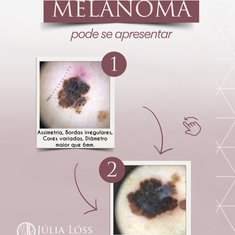 Veja como o melanoma pode se apresentar