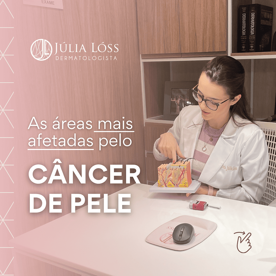 áreas mais afetadas pelo câncer de pele