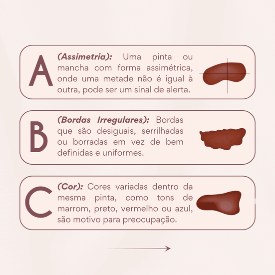 ABCDE DO MELANOMA