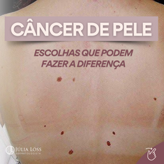 Câncer de pele: escolhas que podem fazer a diferença