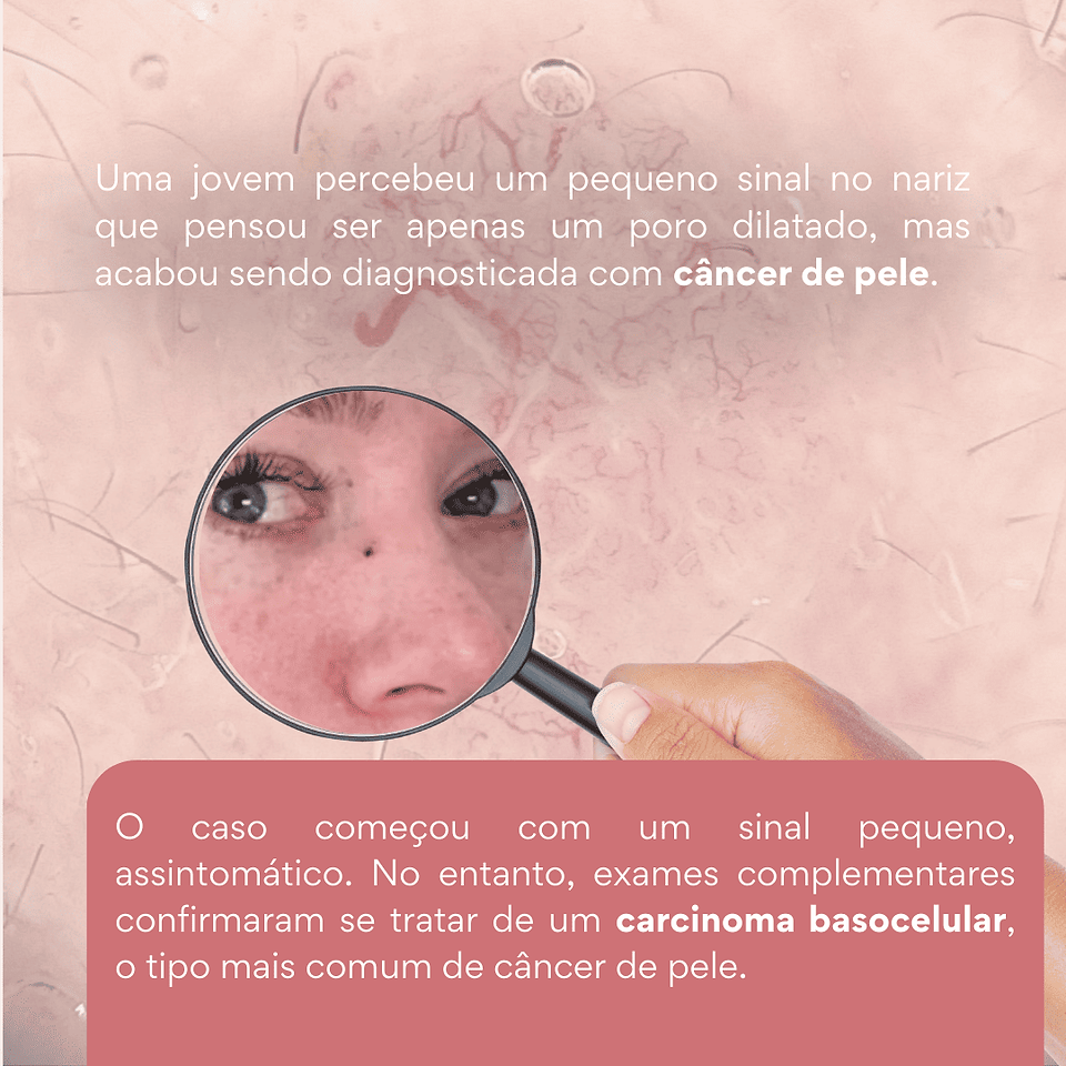 câmaras de bronzeamento