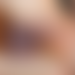 tipos de câncer de pele