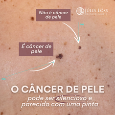 O Câncer de pele pode ser silencioso