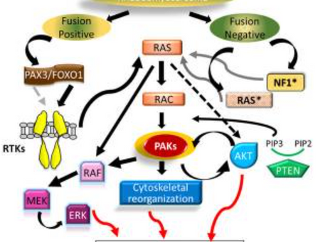 靶向 PAK4 抑制高危横纹肌肉瘤中 Ras 介导的信号传导和多种致癌途径