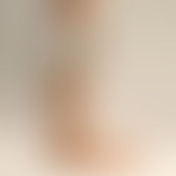 Active Compression Brace: Human tests