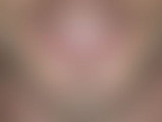 Total cost of dental implants abroad including travel