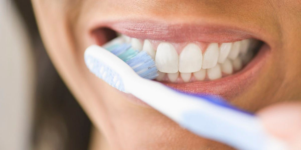 Exemplo de técnica de escovação para facetas no Brooklin Sp.