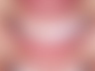 Treatment processes with veneers in Brooklin, SP