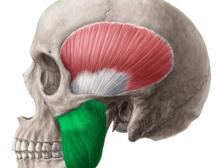 Bruxismo pode mudar o formato do rosto? Entenda o aumento do masseter