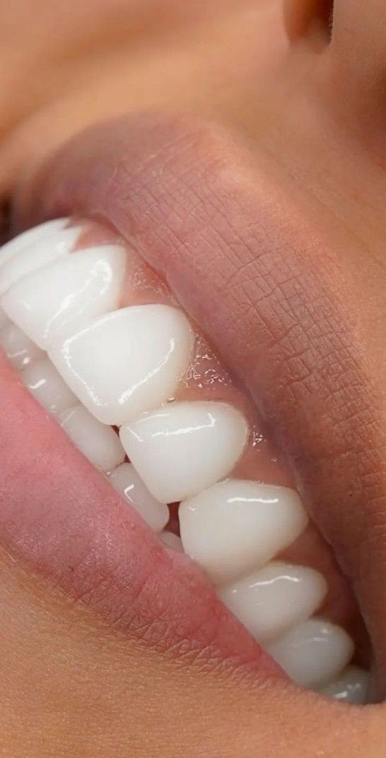 Patient smiles naturally after treatment in Brooklin, SP.