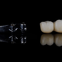 implantation immédiate_edited.jpg