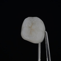 implantologie dentaire_edited.jpg