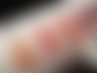 Giảm cân theo chế độ ăn uống Keto: Tại sao cơ thể không đạt trạng thái Ketosis?