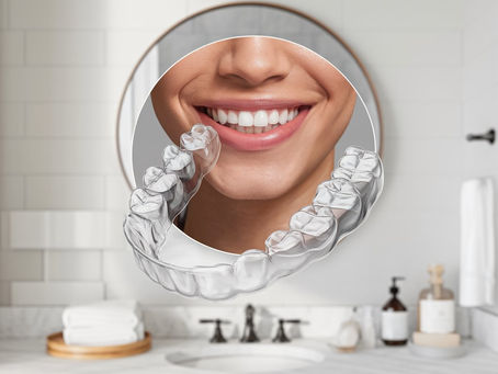 The Benefits of Clear Aligners Over Traditional Braces