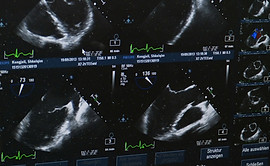 Ultrasounds