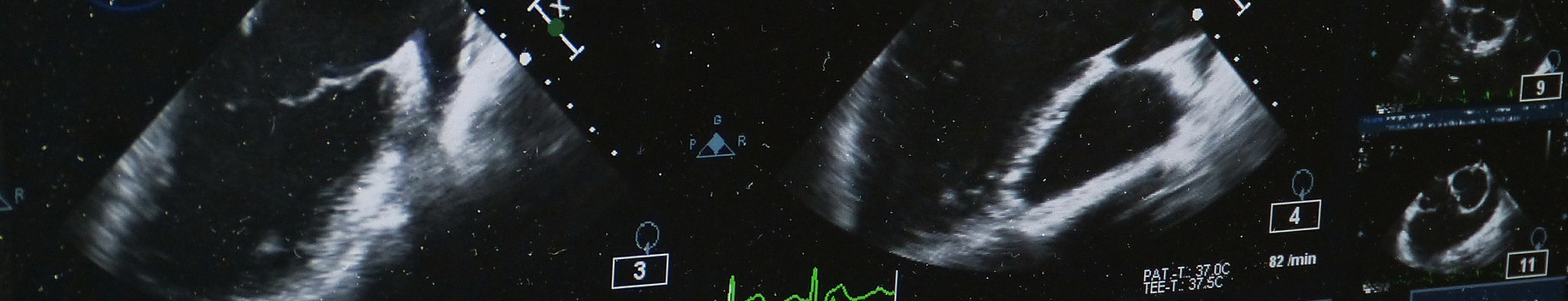 Ultrasounds