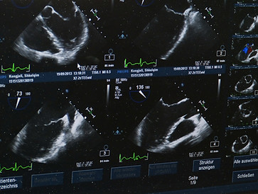 Ultraschall