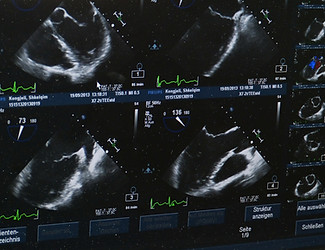Ultrasound Image