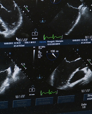 Ultrasounds