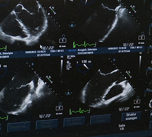 Ultrasounds
