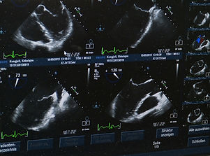 Ultrasounds